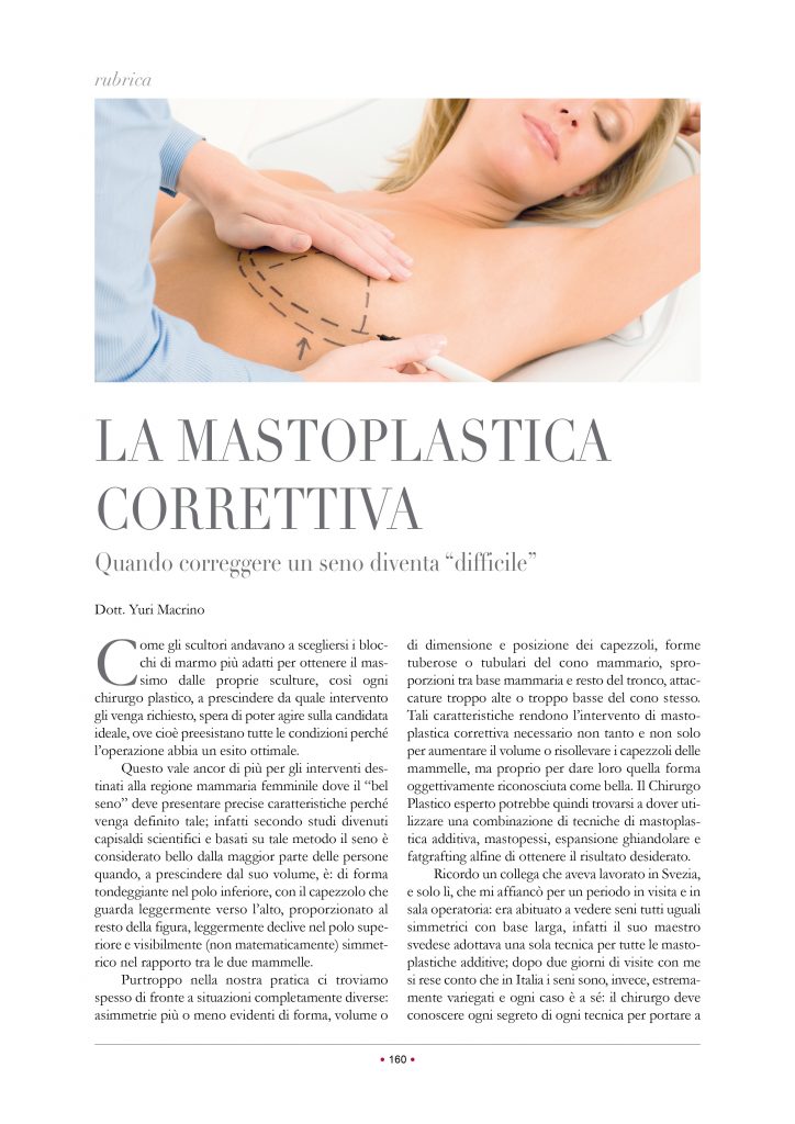 La Mastoplastica Correttiva, articolo di Yuri Macrino su Doctor Charme